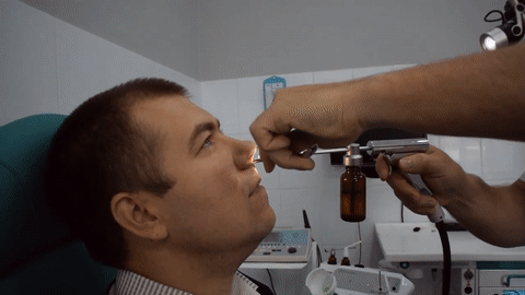 Анестезия пазух носа перед проведением Ямик процедуры