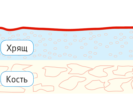 Схема применения эндопротеза нолтрексин - норма